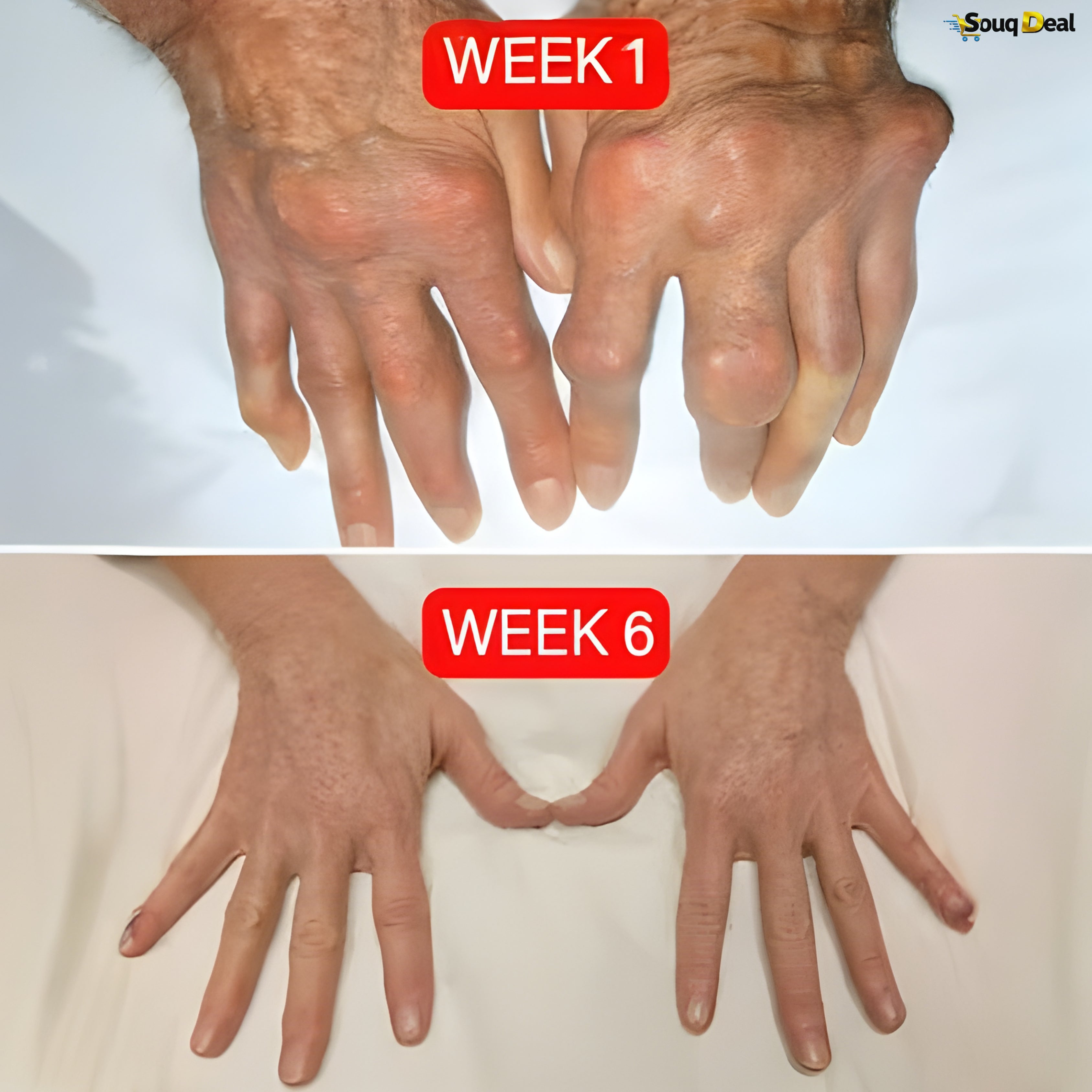 Joint Pain Relief Cream (20g) - Meniscus Pain Relief Ointment