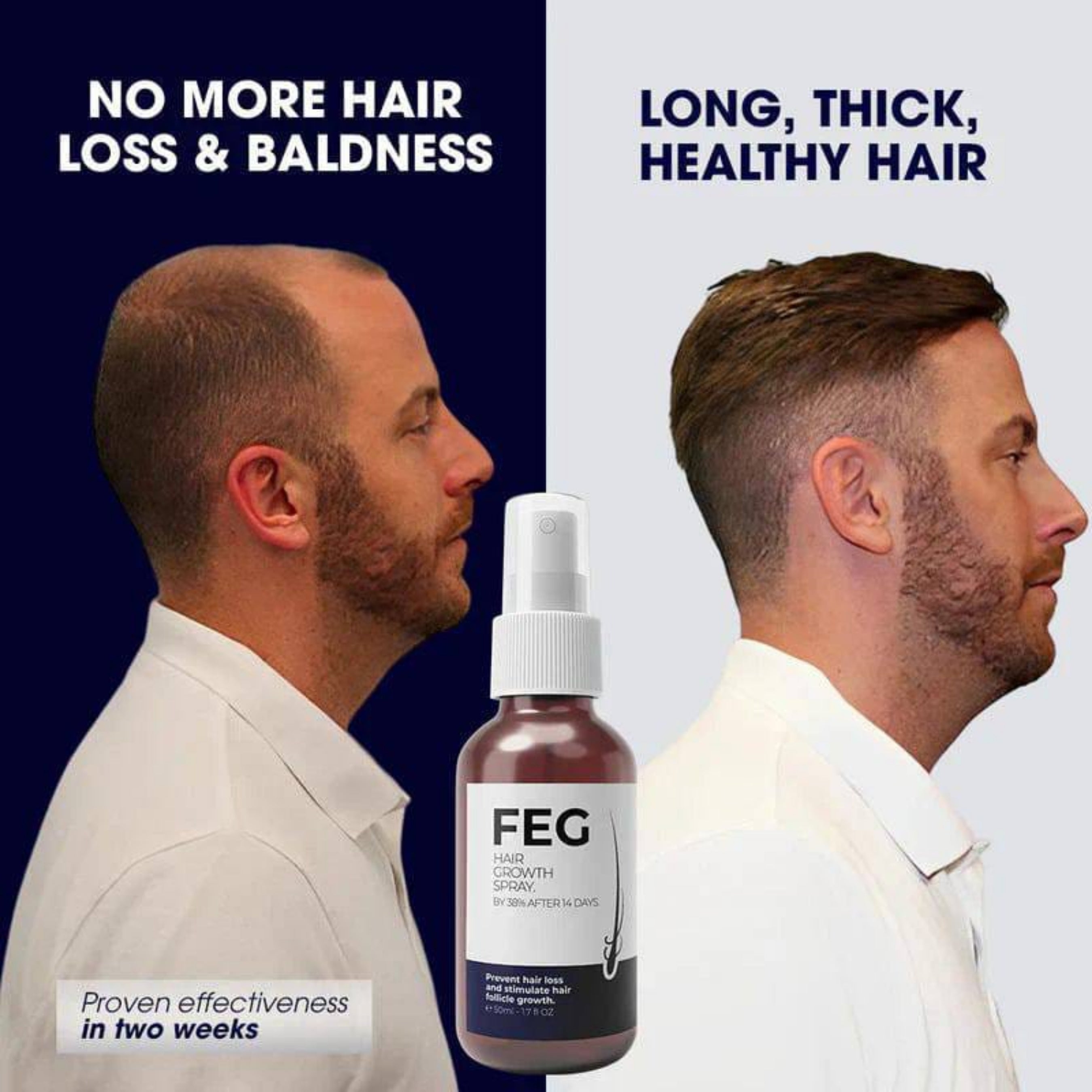 FEG Plus Hair Regrowth Spray – Anti Hair Loss & Patchy Beard Solution